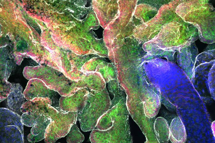Epidermal stem cells